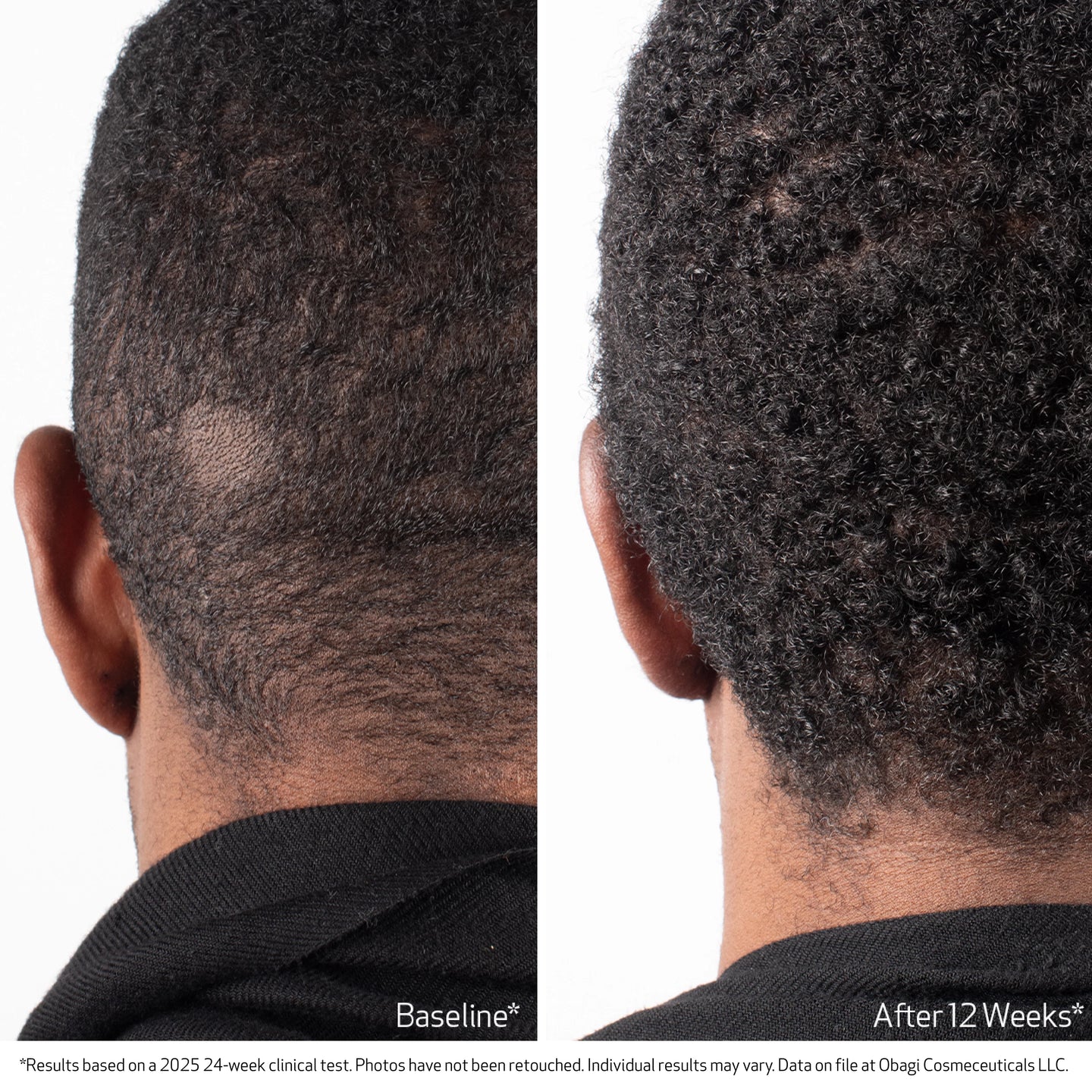 Obagi BioStim™ Scalp Serum