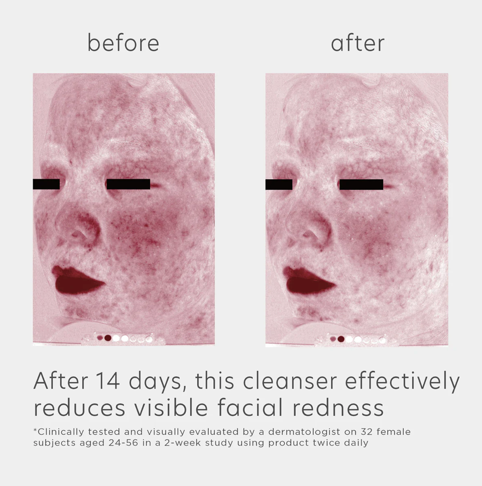 EltaMD® Skin Recovery Amino Acid Foaming Cleanser