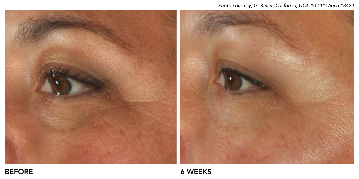 DefenAge 3D Eye Radiance Cream