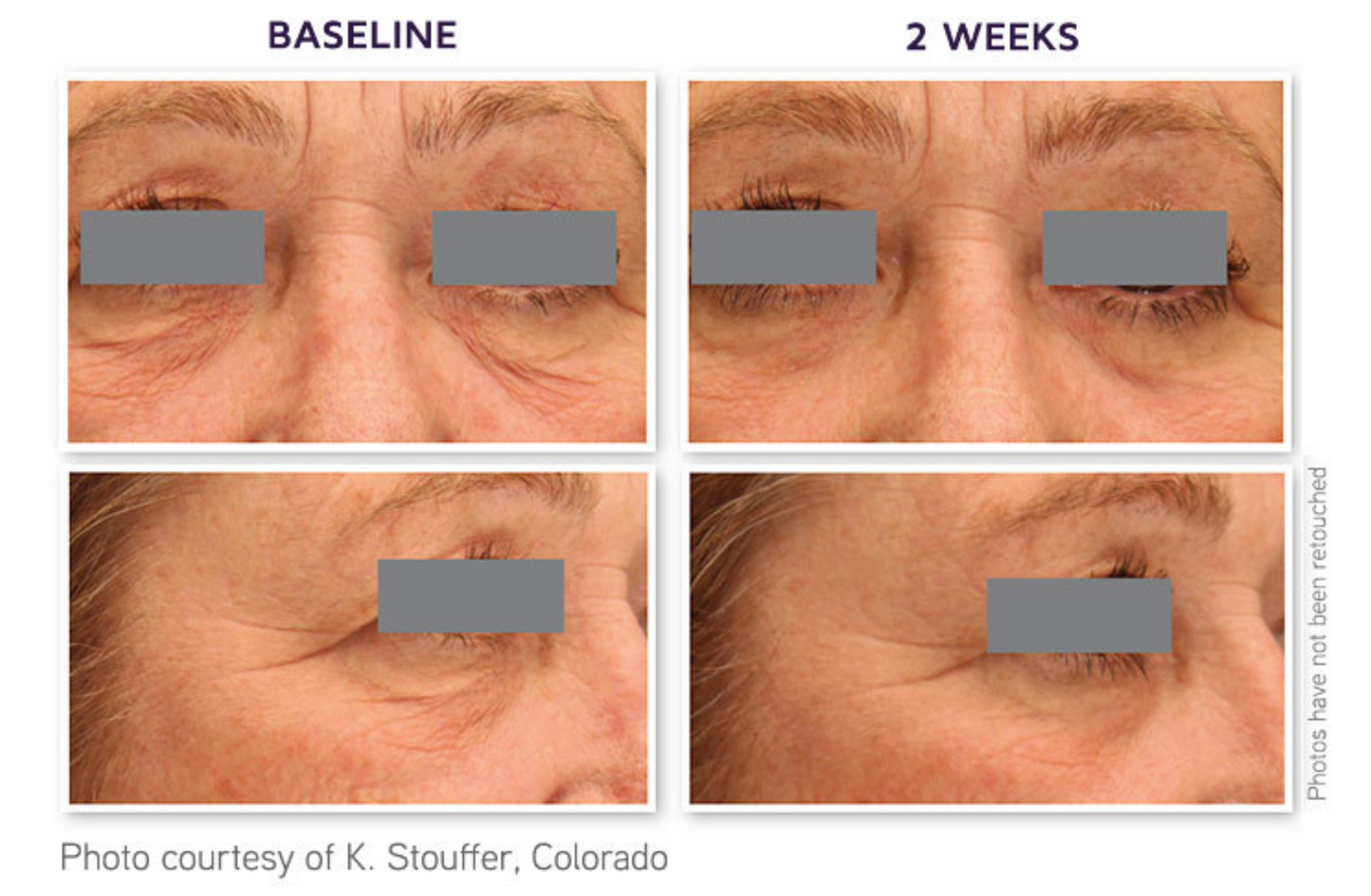 DefenAge 3D Eye Radiance Cream