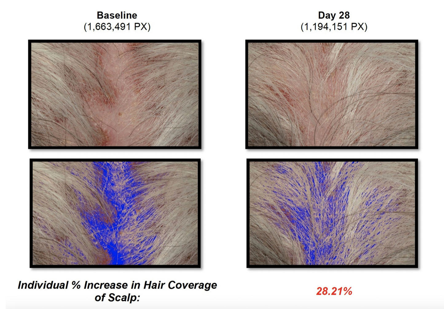 DefenAge 150K Hair Follicle Serum (3-month supply)