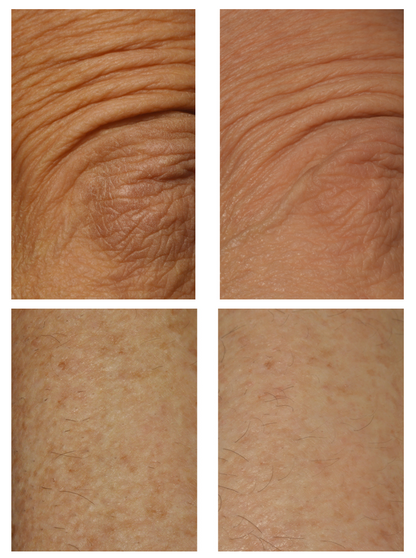 DefenAge 10 Luxe Hand & Body Cream