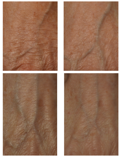 DefenAge 10 Luxe Hand & Body Cream