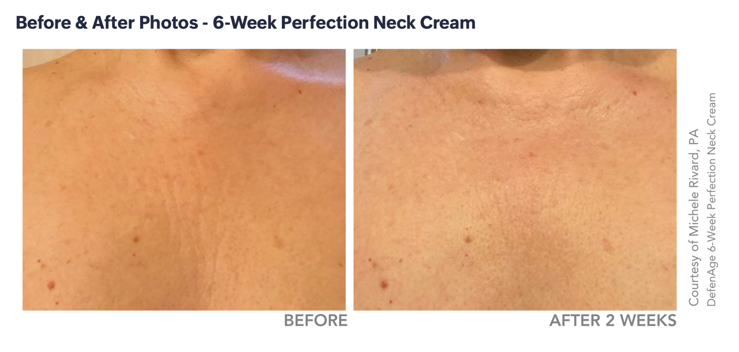 DefenAge 6 Week Neck Perfection Cream