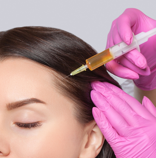 PRP Hair Restoration