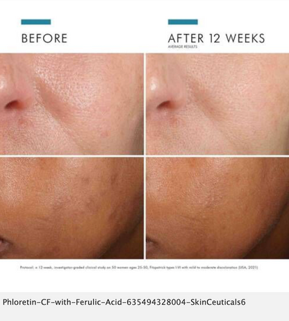 SkinCeuticals Phloretin CF