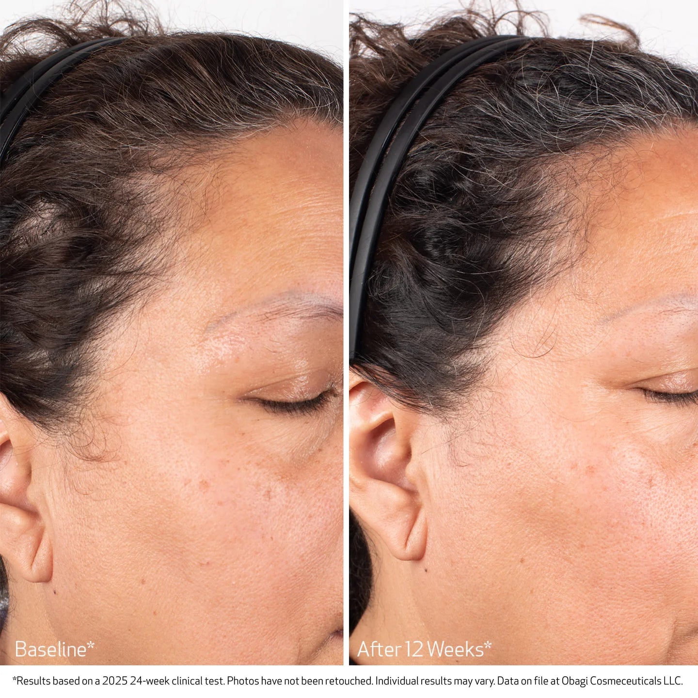 Obagi BioStim™ Scalp Serum