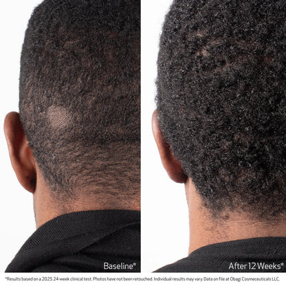 Obagi BioStim™ Scalp Serum