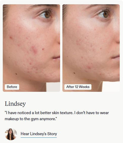 Nutrafol SKIN (3-Month Supply)