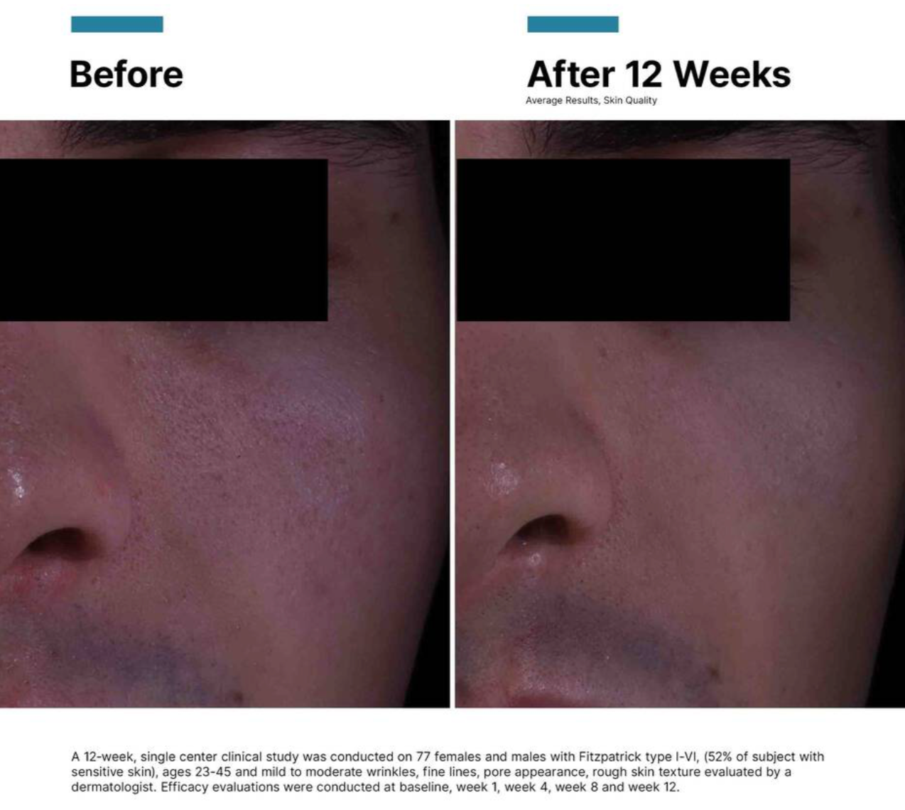 SkinCeuticals P-TIOX Anti-Wrinkle Cream