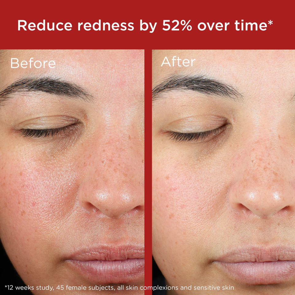 EltaMD® UV Skin Recovery SPF 50 (GREEN TINT)