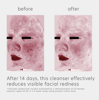EltaMD® Skin Recovery Amino Acid Foaming Cleanser