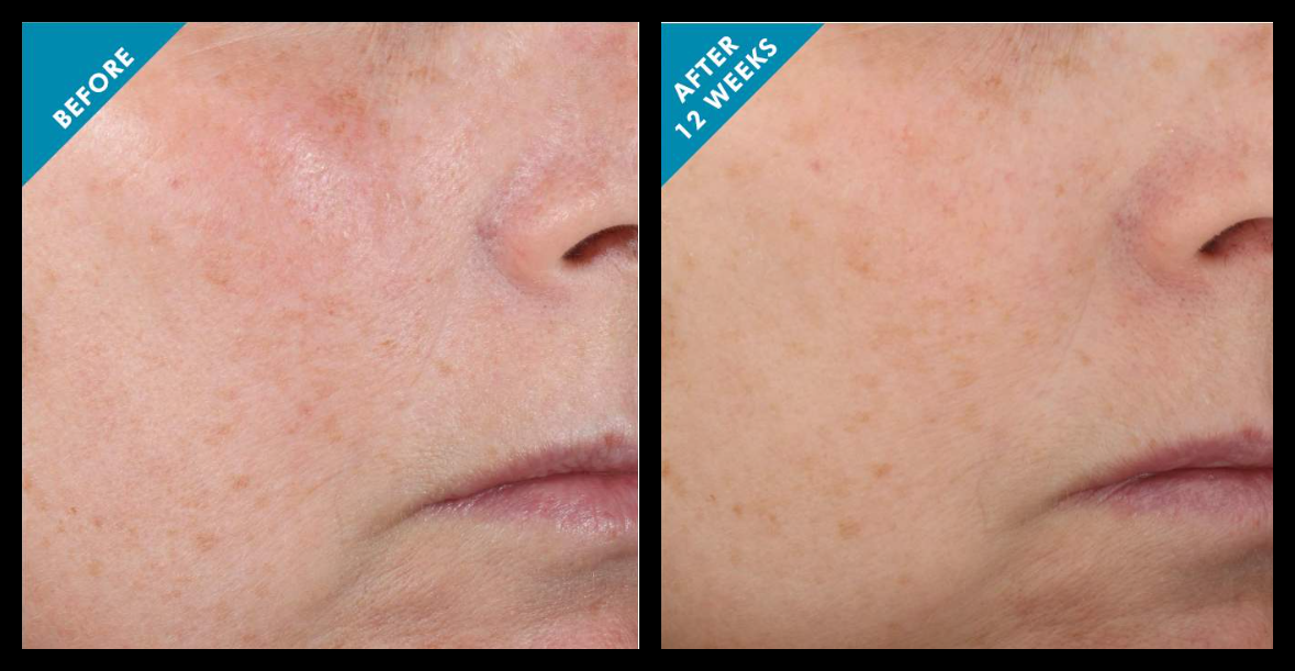 SkinCeuticals Metacell Renewal B3