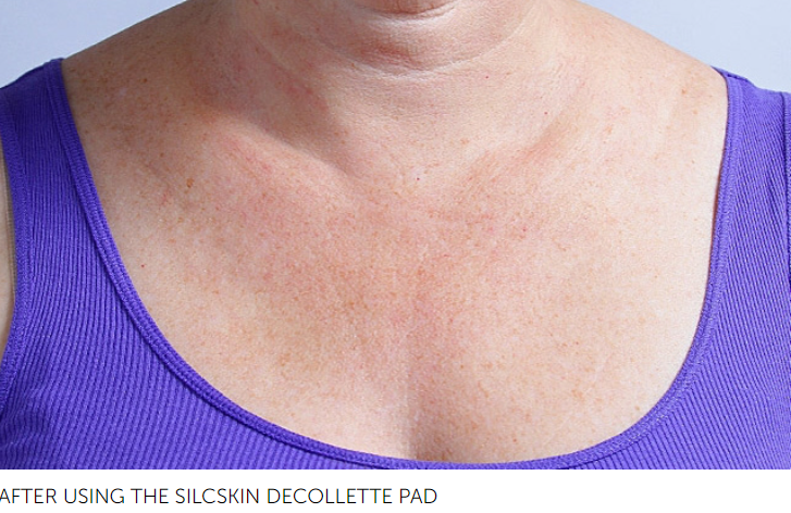 SilcSkin Decollette Pads