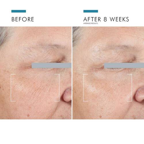 SkinCeuticals A.G.E. Advanced Eye
