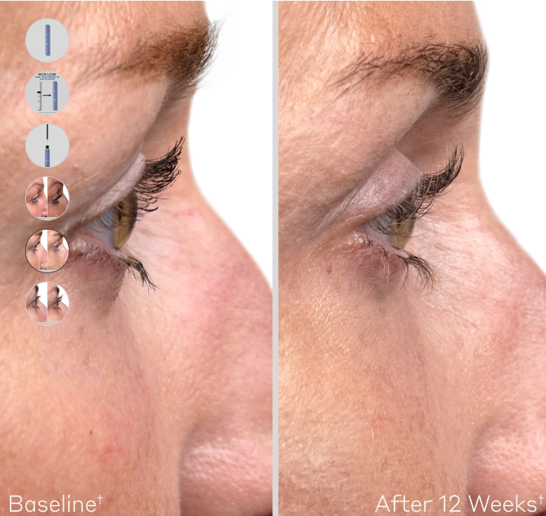 Obagi Nu-Cil™ Eyelash Enhancing Serum