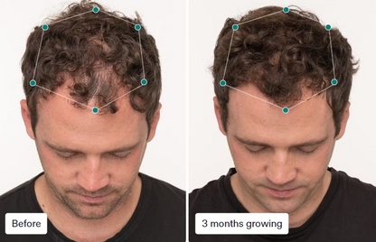 Nutrafol Men's (3-Month Supply)