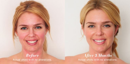 bendBEAUTY Anti-Aging Formula Softgels