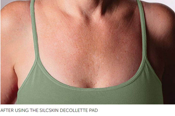 SilcSkin Decollette Pads