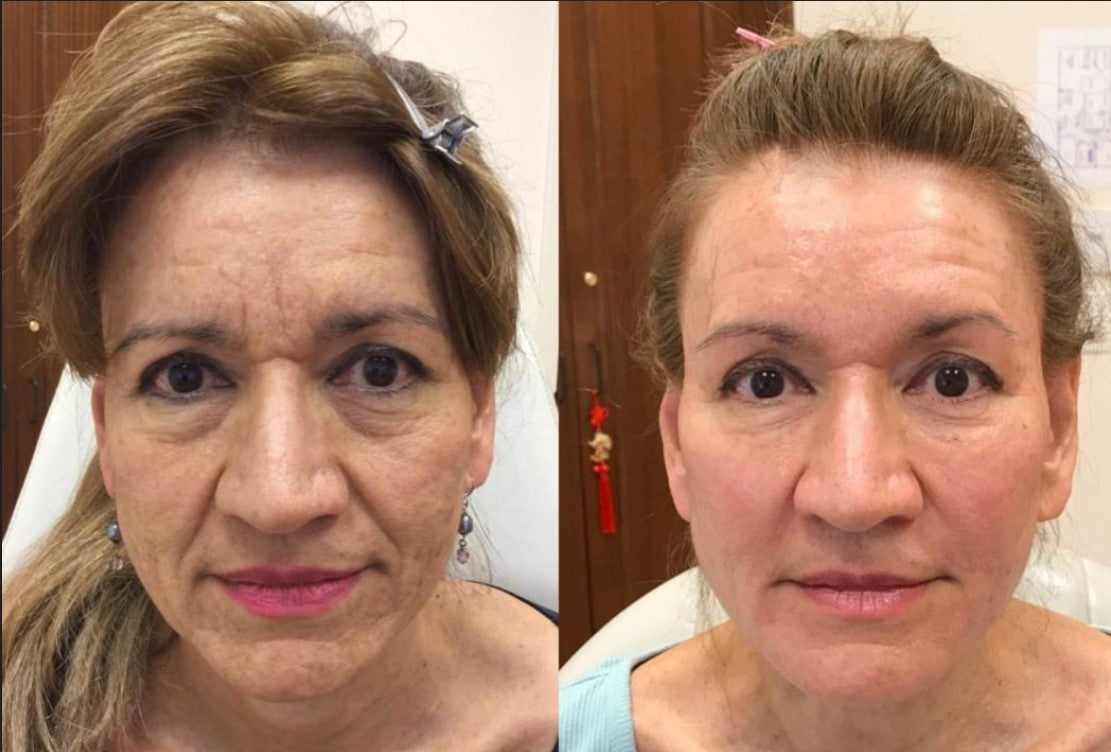 Obagi Tretinoin Cream USP 0.025%