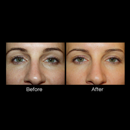 Colorescience® Total Eye™ 3-IN-1 Renewal Therapy SPF 35 (TINTED)