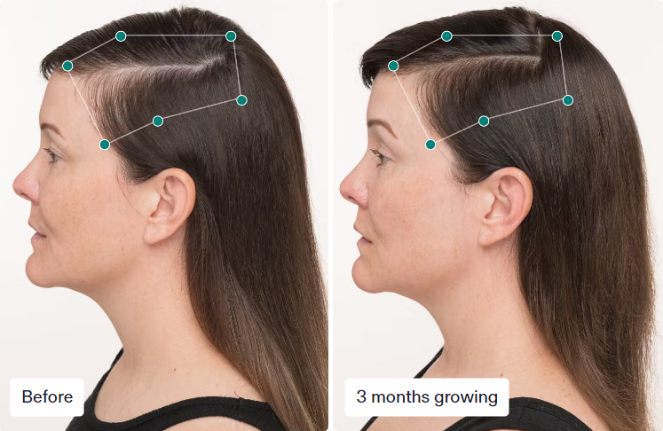 Nutrafol Women's (3-Month Supply)