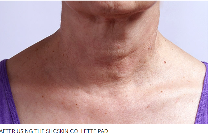 SilcSkin Collette Pads