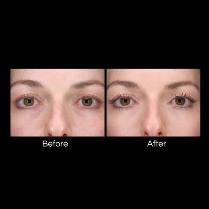 Colorescience® Total Eye™ 3-IN-1 Renewal Therapy SPF 35 (TINTED)