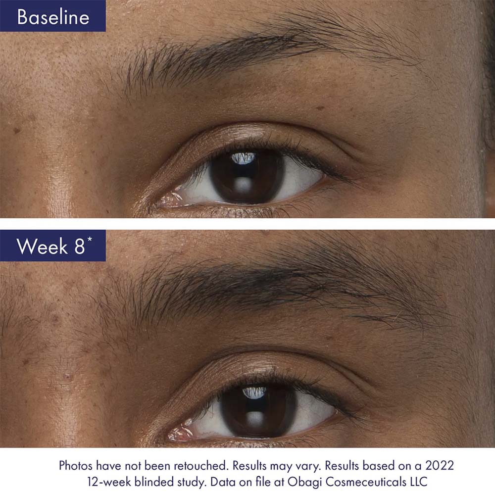 Obagi Nu-Cil™ Eyebrow Boosting Serum