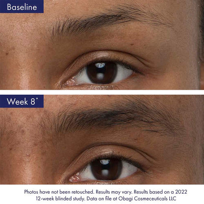 Obagi Nu-Cil™ Eyebrow Boosting Serum