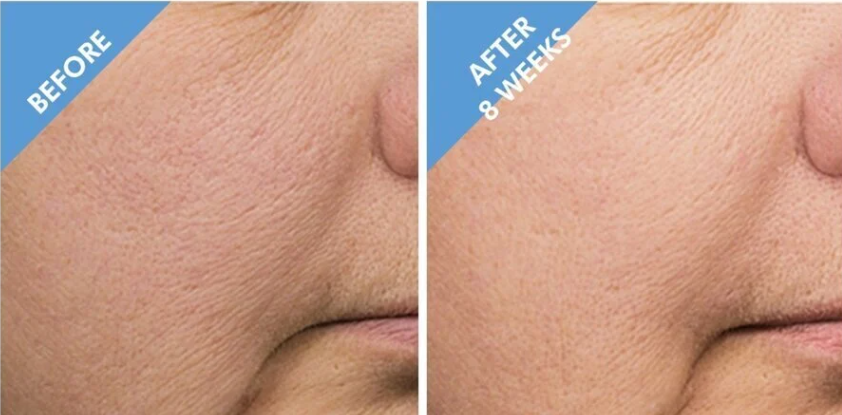 SkinCeuticals Retexturing Activator