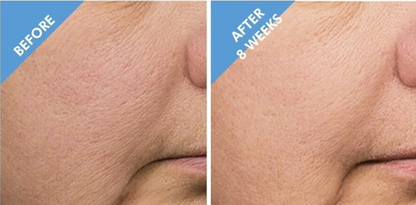 SkinCeuticals Retexturing Activator