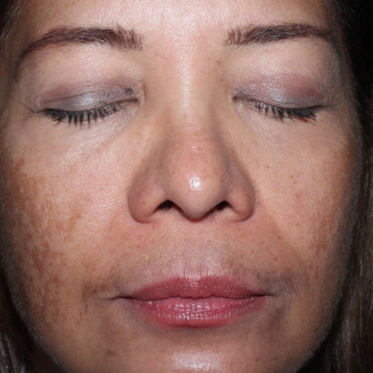 ELEVAI Enfinity Exosome Daily Serum