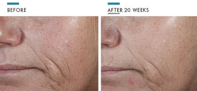 SkinCeuticals CE Ferulic®