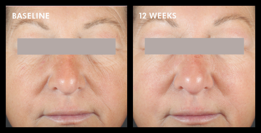 Skinceuticals A.G.E. Interrupter Advanced