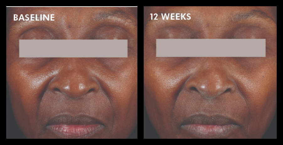 Skinceuticals A.G.E. Interrupter Advanced