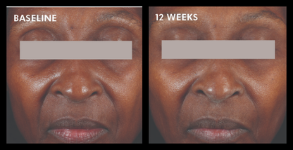 Skinceuticals A.G.E. Interrupter Advanced