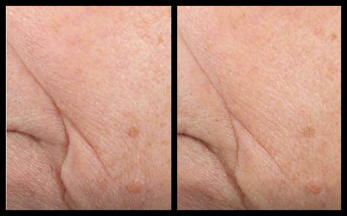 SkinCeuticals Triple Lipid Restore 2:4:2