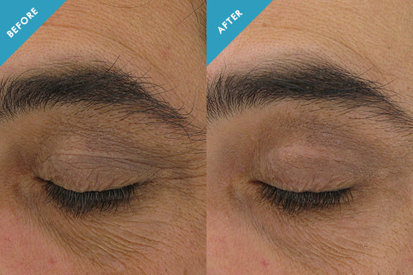 SkinCeuticals AOX® + Eye Gel