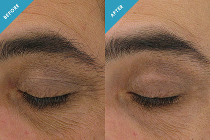 SkinCeuticals AOX® + Eye Gel