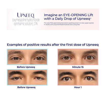 UPNEEQ® (30 single-use containers)