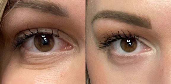 AnteAGE® Eye (15ml)