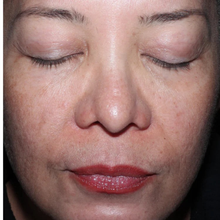 ELEVAI Enfinity Exosome Daily Serum