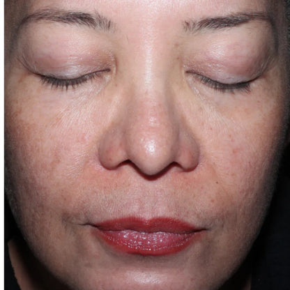 ELEVAI Enfinity Exosome Daily Serum