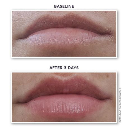 DefenAge 12-Factor Revitalizing Lip Enhancer