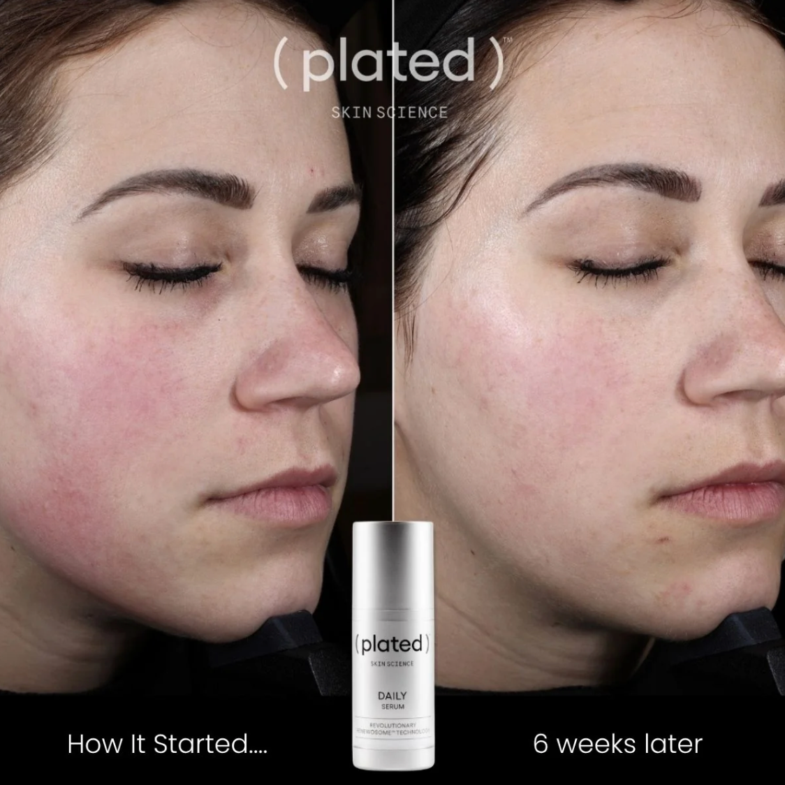 ( plated )™ Skin Science DAILY Serum