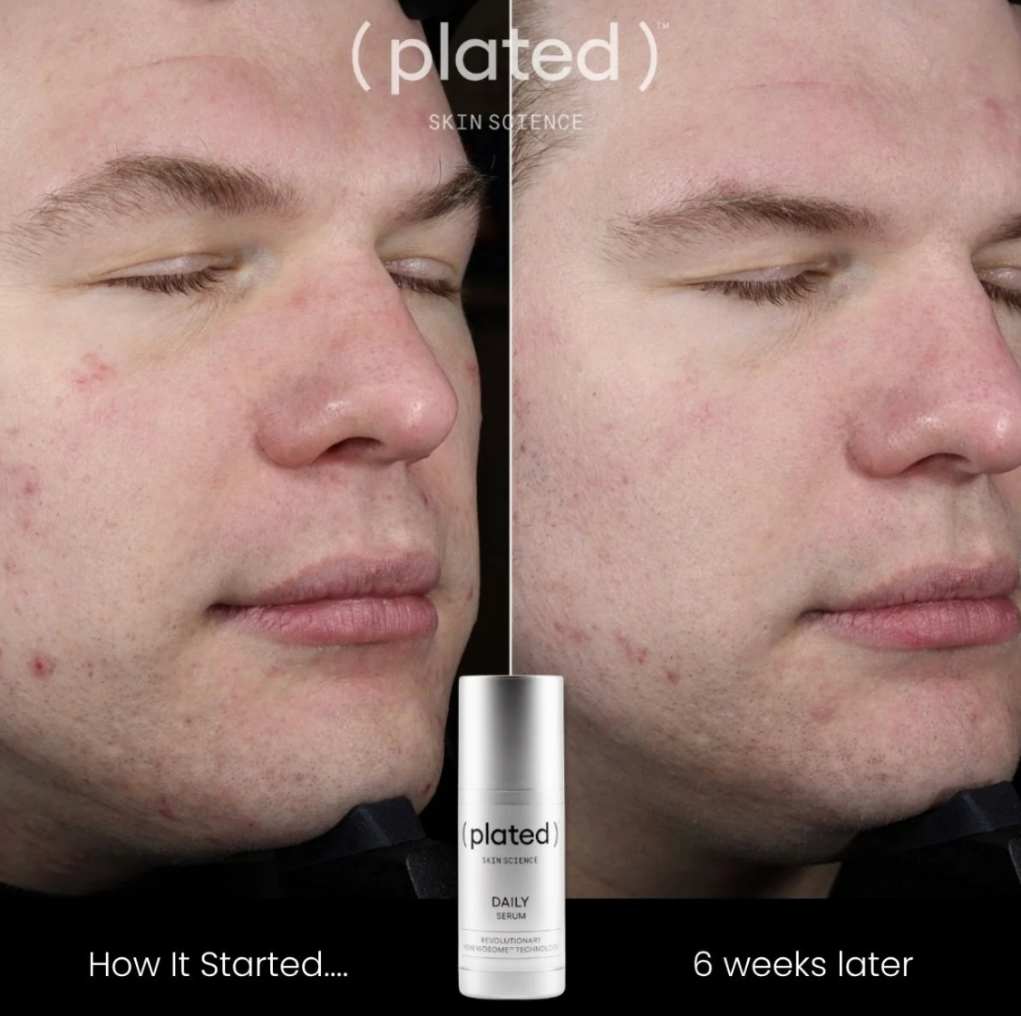 ( plated )™ Skin Science DAILY Serum