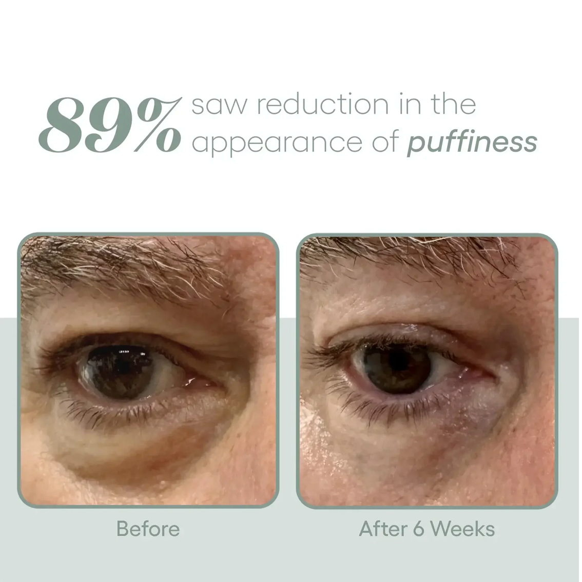 ( plated )™ Skin Science EYE Serum