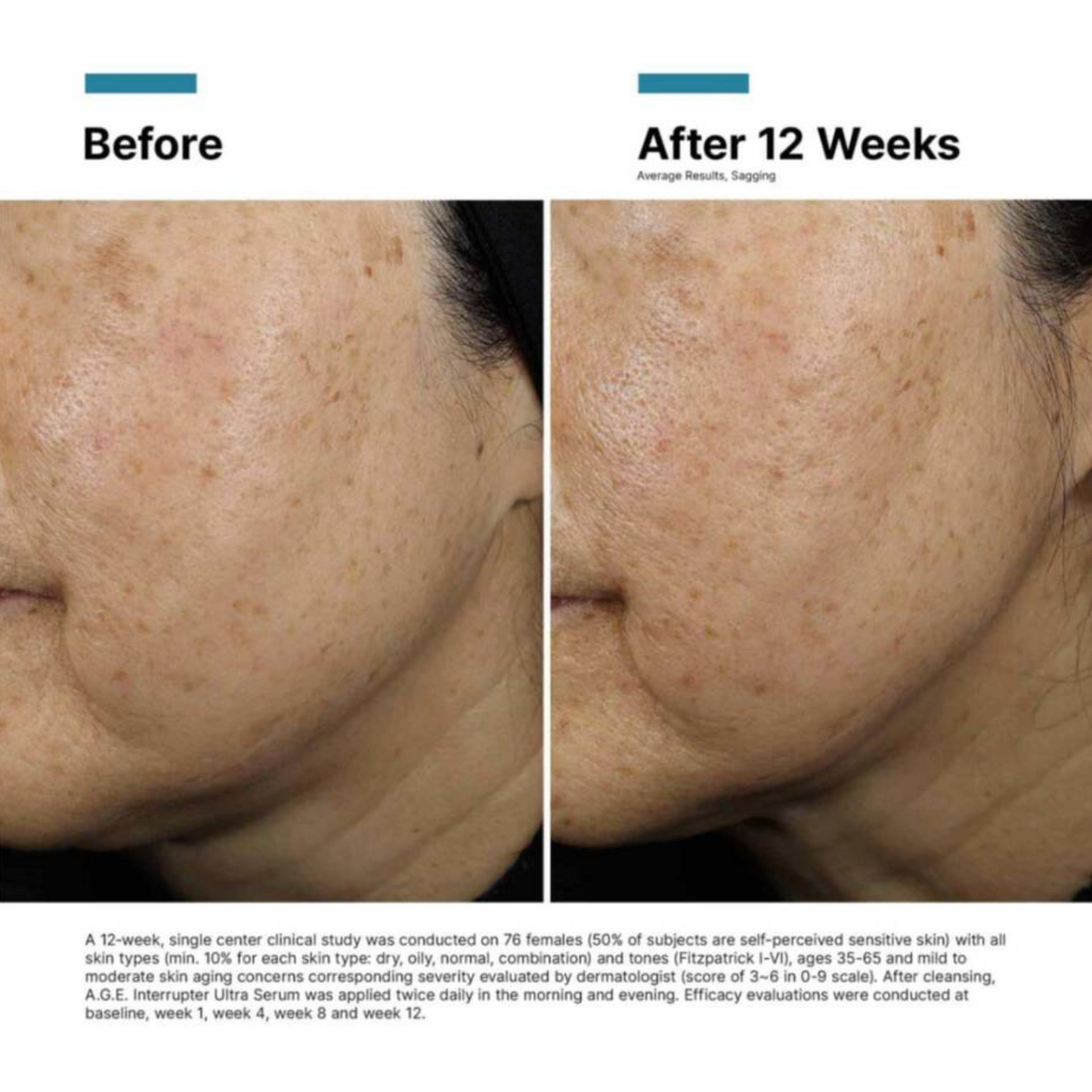 SkinCeuticals A.G.E. Interrupter Ultra Serum